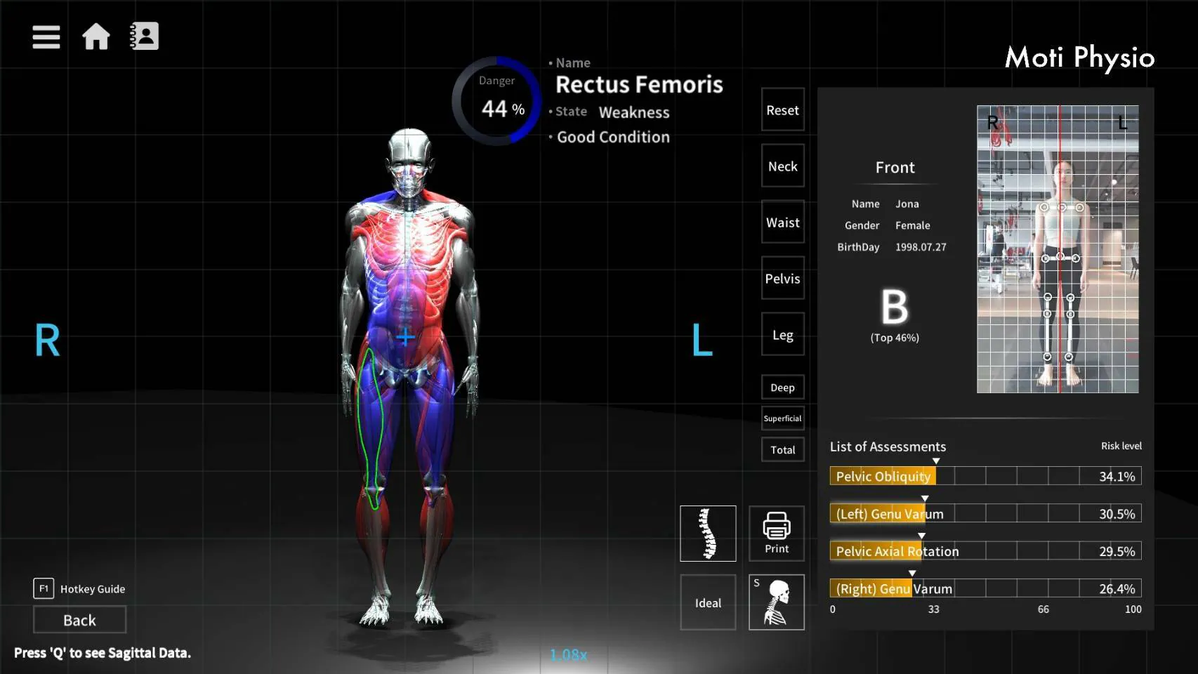 Moti Physio 分析報告